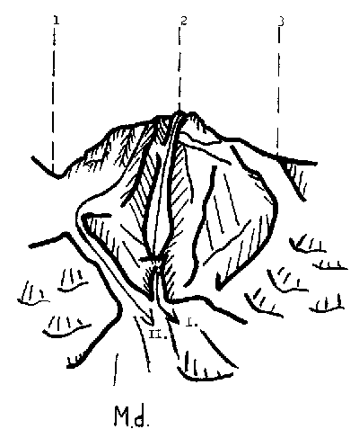 22000ex1.gif (6896 bytes)